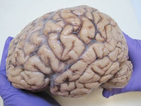 Foto: O cérebro