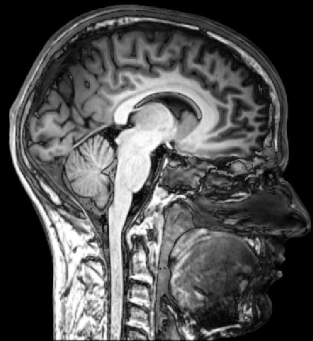 Ressonância magnética de uma cabeça humana: cada parte do cérebro tem função.
